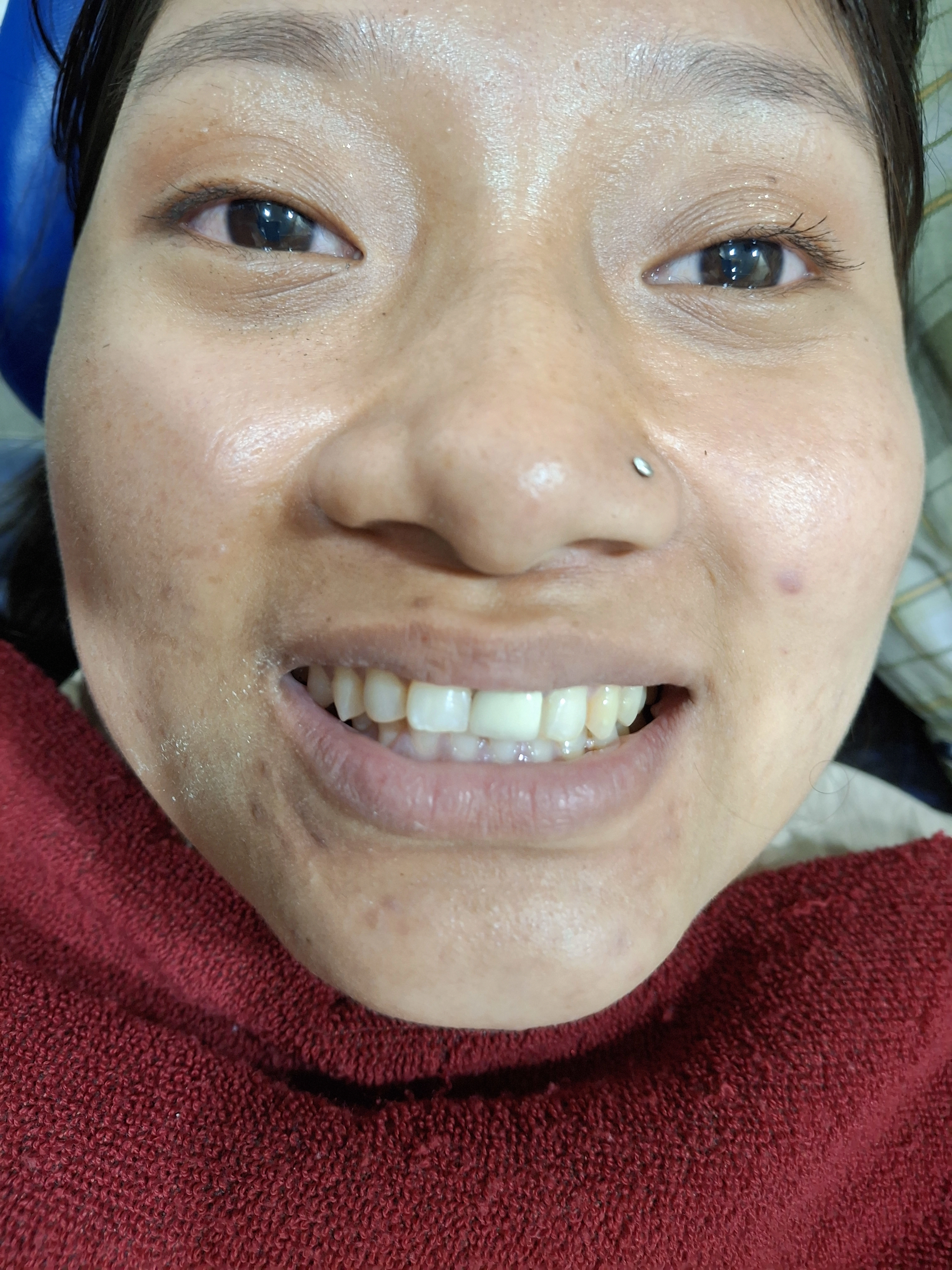 Before